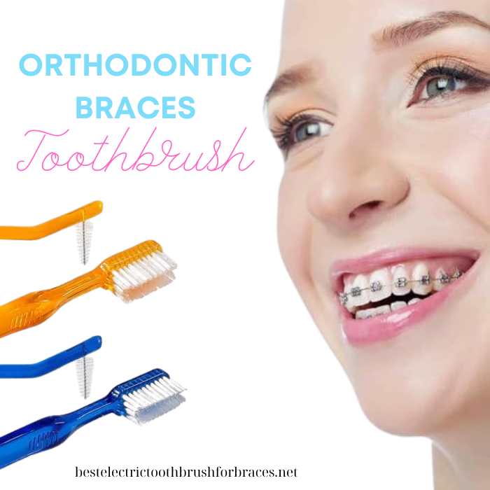 The Orthodontic Braces Toothbrush: Your Guide to Effective Cleaning